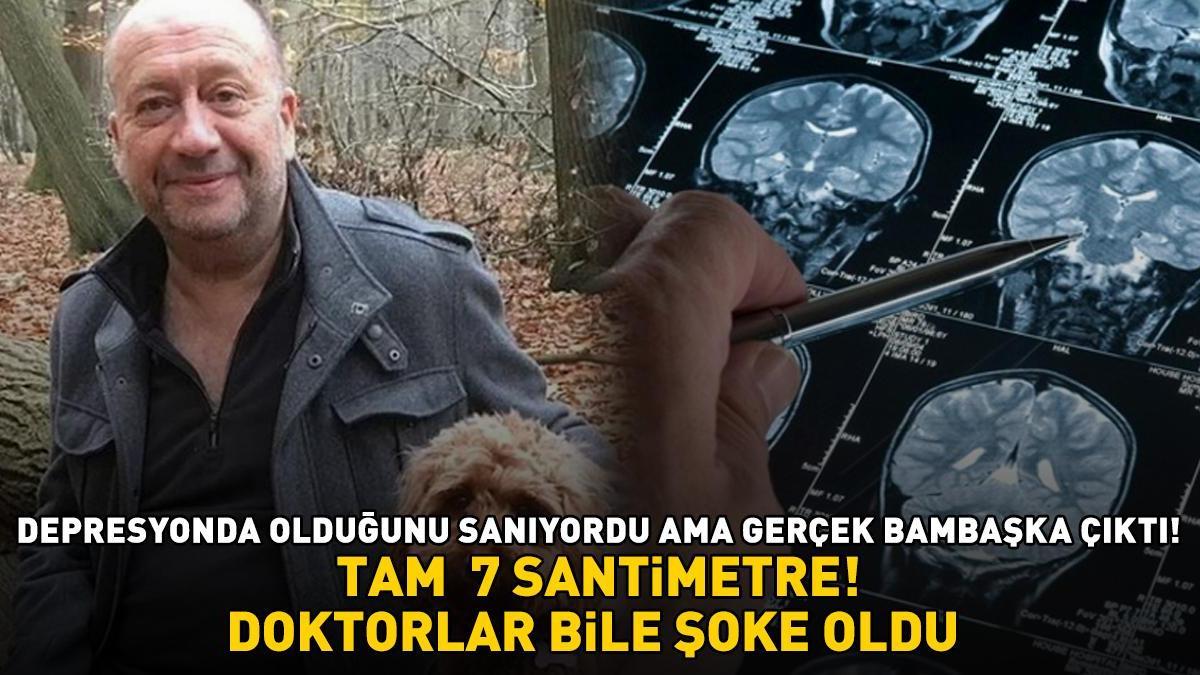 Depresyonda olduğunu sanıyordu, gerçek çok farklı çıktı! Doktorlar bile şaşırdı! TAM  7 SANTİMETRE BOYUNDA!