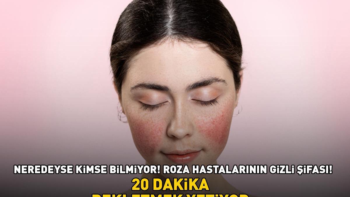Kızarıklık, sivilce benzeri kabarcıklar ve yanma hissi! Roza hastalarının gizli şifası! ’20 dakika bekletmek yetiyor!’