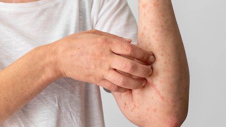 Balık keyfiniz kabusa dönüşmesin! Bir lokması bile büyük riskmiş