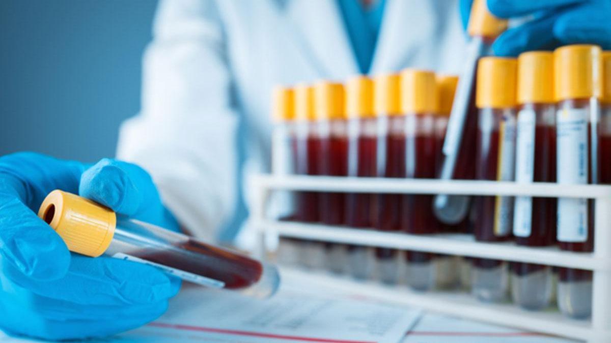 Ferritin Nedir? Ferritin Seviyesi Nasıl Olmalı? Yüksekliği ve Düşüklüğü Sağlığınızı Nasıl Etkiler?