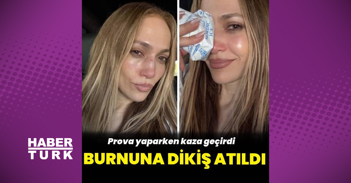 Jennifer Lopez, provada kaza geçirdi